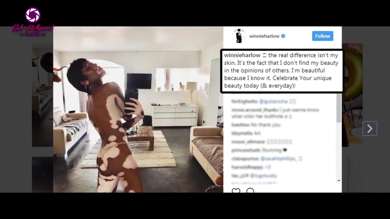 Cumming Winnie Harlow nude in Instagram Jesse Jane